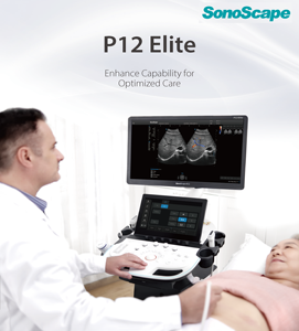 Ecógrafo Sonoscape P12 Elite, Máquina de Ultrasonido, Instrumentos Médicos de Ultrasonido para Hospitales - Product Image 5