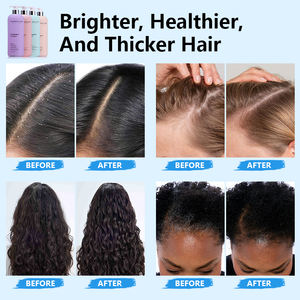 Champú Natural Sin Sulfatos, Orgánico, Voluminizador, <span class=keywords><strong>Tratamiento</strong></span> Anticaída, Fortalece las Raíces, Volumen <span class=keywords><strong>para</strong></span> el Crecimiento <span class=keywords><strong>del</strong></span> <span class=keywords><strong>Cabello</strong></span> - Product Image 6