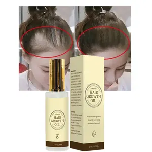 ความงามเครื่องสำอางอินทรีย์ผลิตภัณฑ์ดูแลเส้นผม Argan ป้องกันผมร่วงเจริญเติบโตของเส้นผมการรักษาเซรั่มน้ำมัน