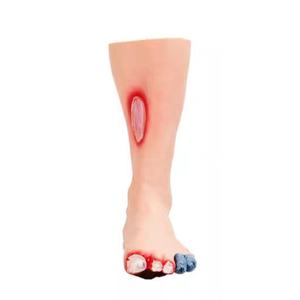 Model Penyakit Kaki Model Perawatan Kaki Diabetik - Product Image 1