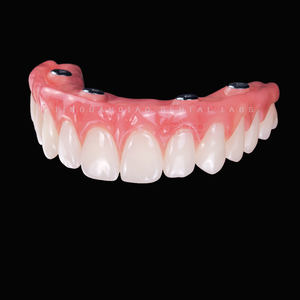 Implant <span class=keywords><strong>dentaire</strong></span> Toutes les couronnes et ponts dentaires <span class=keywords><strong>en</strong></span> céramique avec un <span class=keywords><strong>prix</strong></span> compétitif esthétique élevé - Product Image 1