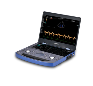 Ecógrafo Médico Portátil Mindray Vetus E7, Certificado CE Clase II, Construcción Metálica, 1 Año de Garantía, Fuente de Alimentación Enchufable - Product Image 3