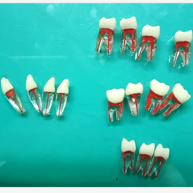 Orale Natuurlijke Wortel Vorm Tand Model Met Anatomische Pulp Cavity Voor Endodontische Training