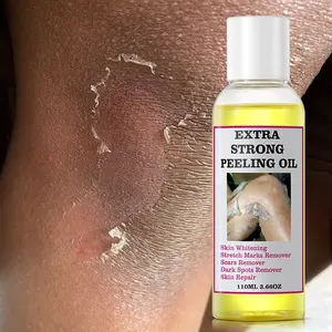 Label Pribadi Ekstra Kuat Mengupas Bekas Luka Minyak Menghilangkan Stretch Mark Whitening Yellow Peeling Oil