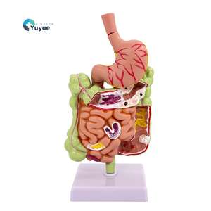 แบบจำลองการสอนทางการแพทย์ รุ่นลำไส้ใหญ่และโรคทางระบบทางเดินอาหาร - Product Image 1