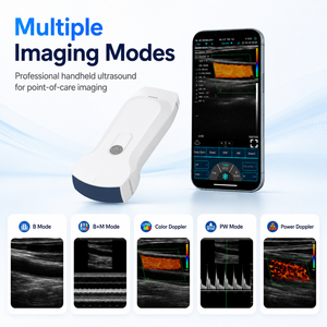 Sonda USB WiFi 3 en 1 para Uso Veterinario Clínico, Ecógrafo <span class=keywords><strong>Doppler</strong></span> Color Portátil - Product Image 5