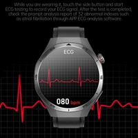 Montre connectée ECG ET456 à succès pour femmes, étanche IP68, surveillance de la fréquence cardiaque, du sommeil, de la santé, suivi des menstruations, Montre Relojes
