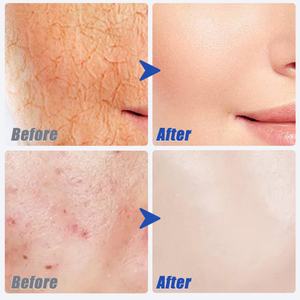 Mascarilla Facial Hidratante y Calmante para el Cuidado de la Piel, con Logotipo Personalizado de Fábrica OEM - Product Image 6