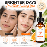 Sérum Visage à la Vitamine C Coréen Anti-Âge Blanchissant Nourrissant Hydratant Marque Blanche Personnalisée pour Peau
