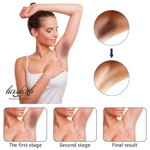 Mới đến axit trái cây AHA dưỡng ẩm sâu làm sáng loại bỏ đốm đen Gel Kem dưỡng da cho da đen - Product Image 5