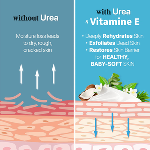 <span class=keywords><strong>Crema</strong></span> <span class=keywords><strong>de</strong></span> <span class=keywords><strong>Urea</strong></span> con Vitamina E al 10%, Mascarilla para Pies, Calcetines para Pies, Absorción Rápida, Hidratación Profunda, Blanqueamiento, Eliminador <span class=keywords><strong>de</strong></span> Callos, Anti-Resequedad - Product Image 6