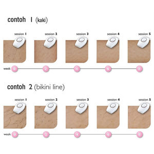 PAKISS 2026, Nueva Depiladora IPL Eléctrica Permanente e Indolora para Uso Doméstico - Product Image 4