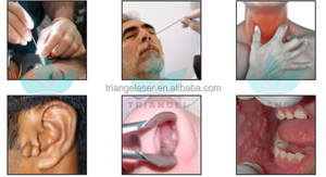 Unit operasi <span class=keywords><strong>Laser</strong></span> ent 980nm, peralatan endoskopi mikro terapi untuk telinga/hidung/tenggorokan unit operasi <span class=keywords><strong>laser</strong></span> ent - Product Image 5