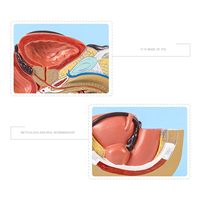 Modelo Anatómico Sagital de Órganos Genitales Internos, Útero, Demostración de Mini Pelvis Femenina, Sistema Reproductivo para Planificación Familiar