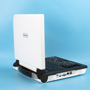 Mesin <span class=keywords><strong>Ultrasound</strong></span> Doppler warna <span class=keywords><strong>Laptop</strong></span> harga murah - Product Image 4