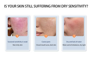 Popular 2026 Máquina Hidrofacial Portátil No Invasiva Hello Face 3 para Minimizar Poros y Limpieza Profunda, 300W, Metal ABS - Product Image 2