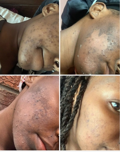 Sponge Spicules Bio Microneedling mengupas Aux Algues 90% rumput laut bubuk kecantikan produk perawatan kulit taces hyperpigmentasi - Product Image 4