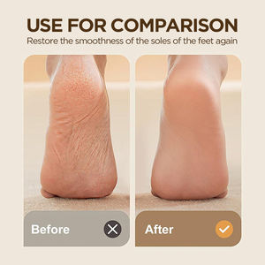 Râpe à <span class=keywords><strong>pieds</strong></span> nano professionnelle en verre pour éliminer les callosités, outil de pédicure pour <span class=keywords><strong>le</strong></span> soin des <span class=keywords><strong>pieds</strong></span> et l'élimination des peaux sèches et gercées - Product Image 3