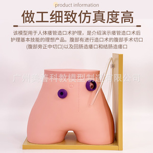 Modèle de soins pour stomies fistulaires ; Modèle d'entraînement aux fistules ; Colostomie ; Modèle d'iléostomie - Product Image 3