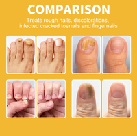 Crème de soin des ongles au venin d'abeille 20g avec logo personnalisé, crème nourrissante à base de plantes pour les soins des ongles
