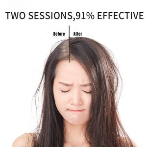 Loción tónica orgánica China para el cabello, suero de esencia de aceite de romero, laca nutritiva para el cabello que ayuda a crecer el cabello Calvo rápidamente - Product Image 4