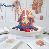 Modèle d'anatomie médicale en plastique du col de l'utérus avec muscles