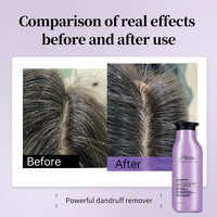 Sampo Anti-Ketombe OEM Voluminous & Smooth dengan Asam Salisilat untuk Rambut Keriting Formula Cair Unisex untuk Dewasa