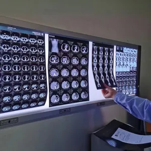 후지 3500 필름 열 프린터 2000 2000 라이트 열 의료 필름 CT DR MRI