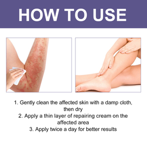 ครีมทาผื่นจากเชื้อรา aati 3วันบรรเทาอาการตะไคร่น้ำสีแดงและอาการ<span class=keywords><strong>คัน</strong></span>ให้ความชุ่มชื้นดูแลผิว - Product Image 5