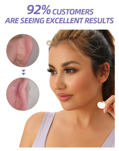 YuMeBeauty, nueva moda, parche invisible para la oreja, corrección de deformidad del oído adulto, adiós al viento, vergüenza para la oreja - Product Image 4
