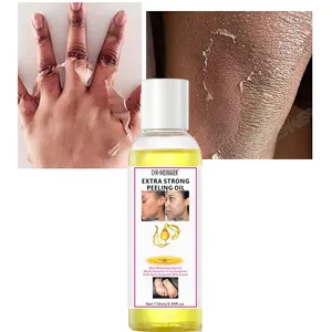 Private Label Skin Anti Dark Spots Exfoliating Whitening Dark Knuckle Remover Peeling Oils Extra Strong Yellow Peeling Oil