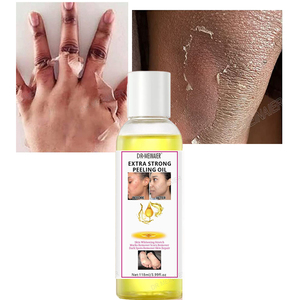Private Label Skin Anti macchie scure esfoliante sbiancante rimozione delle nocche scure oli Peeling olio Peeling giallo Extra forte - Product Image 1