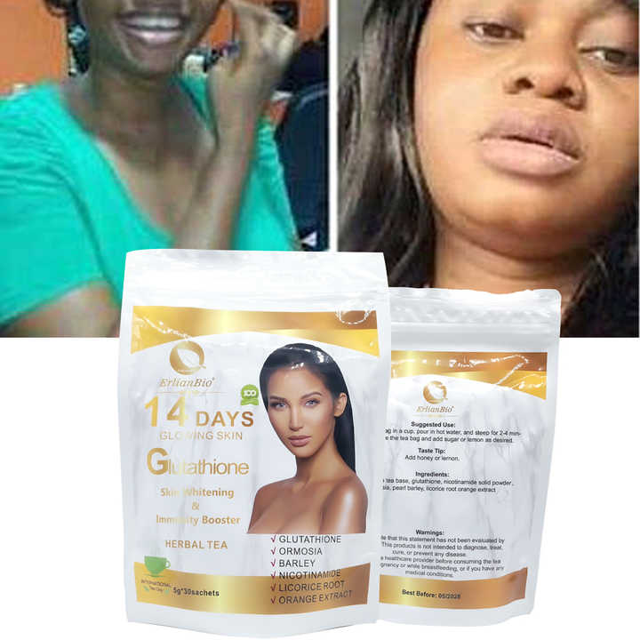 Green Tea Complexion Enhancement Herbal Whitening Collagen Tea With Green  Tea & Poria Cocos - 3 Pack Skin Brightening Tea Bags Chinese Beauty Tea