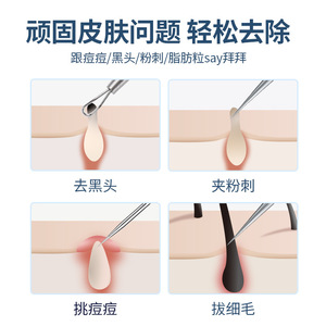 Pinces à cellules en acier inoxydable, pincettes pour éliminer les points noirs, kit d'aiguilles anti-acné de haute précision, outils pour boutons et points noirs pour salon de beauté - Product Image 3