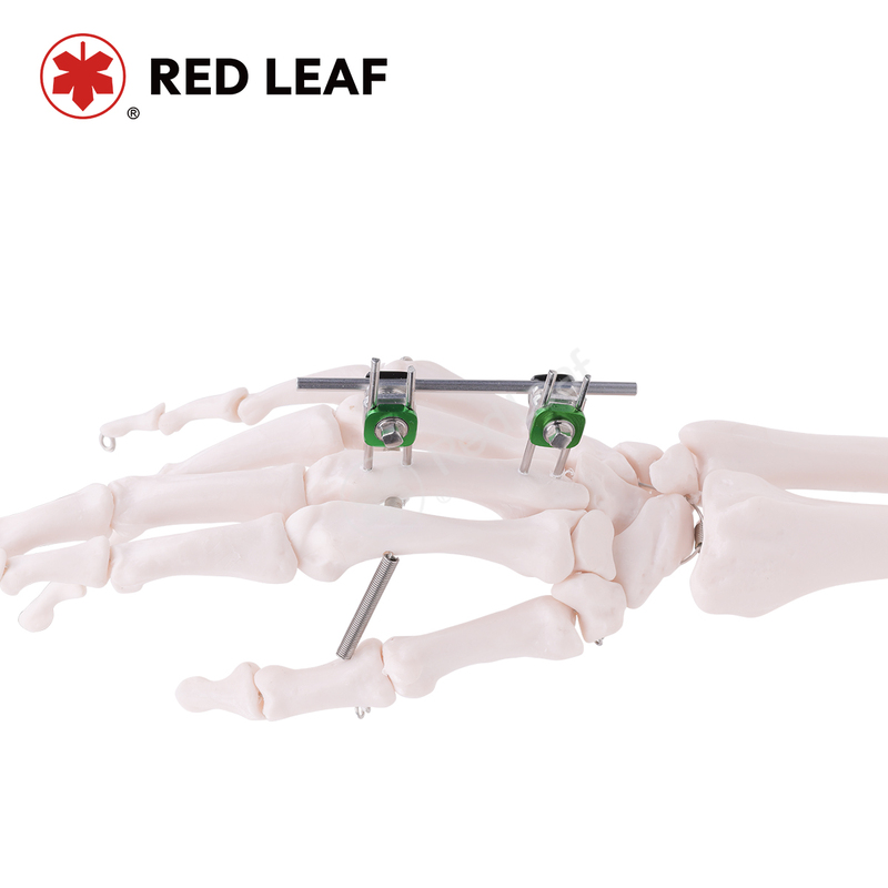Combination Thighbone Orthopedic External Fixation System