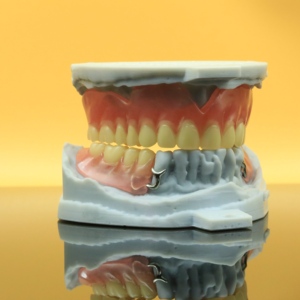 Metaal 3D-dentale print, compact en stevig, gemaakt van kobalt-chroomlegering - Product Image 4