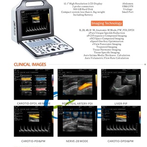 Échographe portable à prix d'usine, machine d'échographie B-Scan haute résolution pour l'abdomen, appareil vétérinaire BW21A - Product Image 6