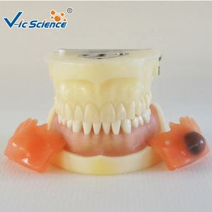 Modèle de dents dentaires d'enseignement médical pour la pratique de la coupe de <span class=keywords><strong>kyste</strong></span> - Product Image 5