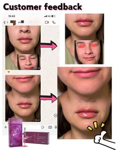 Natural Volume Lip Filler with <strong>Vitamin</strong> <strong>B12</strong> and Hyaluronic Acid - Product Image 4