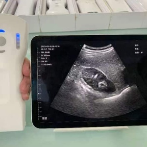 Échographe portable sans fil DCU19H, 64 canaux, échographe de poche, échographe médical professionnel - Product Image 6