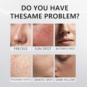 Crème éclaircissante pour le <span class=keywords><strong>visage</strong></span> et le corps, élimination des taches, réduction des taches de 39%, 28 jours, acide tranexamique, contrôle de la mélanine à 4 voies pour tous les types de peau - Product Image 3