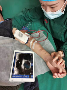 Sonda lineal Gelt 14MHz ultrasonido inalámbrico para vena - Product Image 6