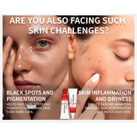 Gel Crème Visage Léger Éclaircissant Anti-Acné à l'Acide Salicylique Hydratant Apaisant Réparateur des Pores
