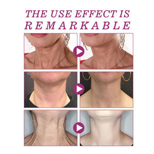 Oem Hidrolizado Colágeno Suavizante y Aclarador Líneas del Cuello Belleza Crema PARA EL Cuello Adultos Hidratante Cara Mujer Piel Hidratante - Product Image 3