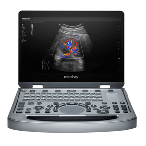 Ecógrafo Veterinario Digital Mindray MX6 con Doppler Color 3D 4D, Precio Competitivo para Uso Veterinario - Product Image 4