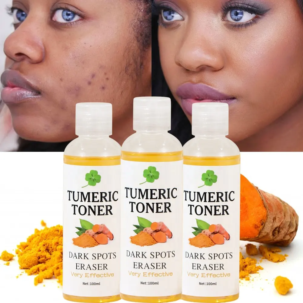 OEM Customized Remove Dark Spots Turmeric Toner Eraser Corrector Private Label Water Based Face Moisturizer Skin Toner