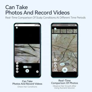 Uso domestico analizzatore di follicolo pilifero e rilevatore di pelle analizzatore USB telefono Android Tablet compatibile per test del cuoio capelluto strumento - Product Image 4