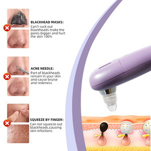 Dsp <b>Vacuum</b> <b>Blackhead</b> <b>Remover</b> Electric Rechargeable For Face With Usb Charging - Product Image 2