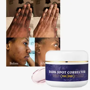 Strong Removal 7 Days Dark Spot Corrector Skin Care Private Label Whitening Freckle Face Cream