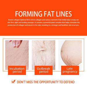 125ml tinh khiết cần thiết cho dầu sinh học cho phụ nữ mang thai dầu chăm sóc da đặc biệt để làm mờ dần và vết rạn da - Product Image 5